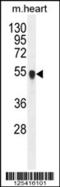 Protein Phosphatase, Mg2+/Mn2+ Dependent 1L antibody, 55-550, ProSci, Western Blot image 