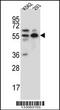 NEDD8 Activating Enzyme E1 Subunit 1 antibody, 56-829, ProSci, Western Blot image 