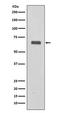 Complement C9 antibody, M01010, Boster Biological Technology, Western Blot image 