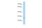 Insulin Like Growth Factor Binding Protein 5 antibody, PA5-70003, Invitrogen Antibodies, Western Blot image 