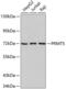 Protein Arginine Methyltransferase 5 antibody, 18-600, ProSci, Western Blot image 