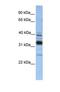 Thioredoxin Related Transmembrane Protein 4 antibody, NBP1-69606, Novus Biologicals, Western Blot image 