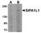 Signal Induced Proliferation Associated 1 Like 1 antibody, PA5-20847, Invitrogen Antibodies, Western Blot image 