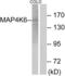 Misshapen Like Kinase 1 antibody, LS-C119142, Lifespan Biosciences, Western Blot image 