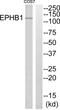 EPH Receptor B1 antibody, abx015160, Abbexa, Western Blot image 