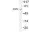 CD5 Molecule antibody, LS-C176492, Lifespan Biosciences, Western Blot image 