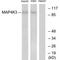 Mitogen-Activated Protein Kinase Kinase Kinase Kinase 3 antibody, PA5-49845, Invitrogen Antibodies, Western Blot image 