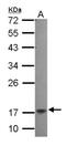 NFKB Inhibitor Interacting Ras Like 2 antibody, NBP2-19545, Novus Biologicals, Western Blot image 