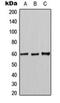 MutY DNA Glycosylase antibody, orb216162, Biorbyt, Western Blot image 