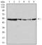 Mitogen-Activated Protein Kinase 10 antibody, NBP2-61801, Novus Biologicals, Western Blot image 