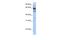 Zinc Finger Protein 564 antibody, A14786, Boster Biological Technology, Western Blot image 
