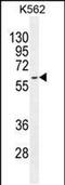 Keratin 73 antibody, PA5-48147, Invitrogen Antibodies, Western Blot image 