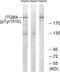 Integrin Subunit Beta 4 antibody, 79-817, ProSci, Western Blot image 