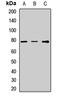 Transforming Growth Factor Beta Induced antibody, LS-C668059, Lifespan Biosciences, Western Blot image 