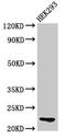 Histone Cluster 1 H1 Family Member E antibody, LS-C670371, Lifespan Biosciences, Western Blot image 