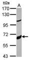 Cytochrome P450 Family 17 Subfamily A Member 1 antibody, PA5-27777, Invitrogen Antibodies, Western Blot image 