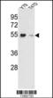 Eukaryotic Translation Elongation Factor 1 Alpha 1 antibody, MBS9201228, MyBioSource, Western Blot image 
