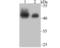 SWI/SNF Related, Matrix Associated, Actin Dependent Regulator Of Chromatin, Subfamily B, Member 1 antibody, NBP2-75669, Novus Biologicals, Western Blot image 