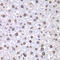 DNA Topoisomerase I antibody, A00434, Boster Biological Technology, Immunohistochemistry frozen image 