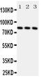 Ribosomal Protein S6 Kinase A1 antibody, PA2052, Boster Biological Technology, Western Blot image 