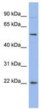 High Mobility Group Box 4 antibody, TA345518, Origene, Western Blot image 