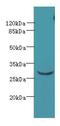 Coiled-Coil Domain Containing 127 antibody, LS-C378554, Lifespan Biosciences, Western Blot image 