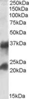 Clathrin light chain A antibody, NBP1-05035, Novus Biologicals, Western Blot image 