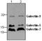 Galectin 9 antibody, GTX59744, GeneTex, Western Blot image 
