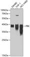 PDZ Binding Kinase antibody, GTX33388, GeneTex, Western Blot image 