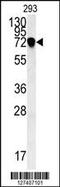 Neuron Derived Neurotrophic Factor antibody, 62-056, ProSci, Western Blot image 