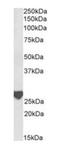 Latexin antibody, orb389373, Biorbyt, Western Blot image 