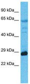 Mediator Complex Subunit 6 antibody, TA343540, Origene, Western Blot image 