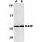TNF Superfamily Member 13b antibody, PA1-30556, Invitrogen Antibodies, Western Blot image 