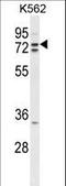 Zinc Finger RANBP2-Type Containing 1 antibody, LS-C160970, Lifespan Biosciences, Western Blot image 