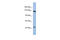 Slit Guidance Ligand 1 antibody, ARP58765_P050, Aviva Systems Biology, Western Blot image 