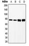 Lymphocyte Cytosolic Protein 2 antibody, LS-C352442, Lifespan Biosciences, Western Blot image 