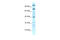 Zinc Finger Protein 23 antibody, 27-875, ProSci, Enzyme Linked Immunosorbent Assay image 