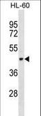 Tektin 1 antibody, LS-C161796, Lifespan Biosciences, Western Blot image 