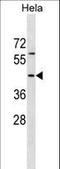 RNA Binding Motif Protein 41 antibody, LS-C158824, Lifespan Biosciences, Western Blot image 