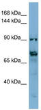 Cation Channel Sperm Associated Auxiliary Subunit Delta antibody, TA330925, Origene, Western Blot image 