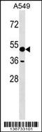 Amylase Alpha 1C (Salivary) antibody, 59-283, ProSci, Western Blot image 