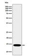 Histone Cluster 2 H2B Family Member E antibody, M07286-3, Boster Biological Technology, Western Blot image 