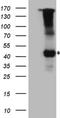 Interleukin 12 Receptor Subunit Beta 1 antibody, NBP2-45392, Novus Biologicals, Western Blot image 
