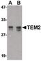 RASD Family Member 2 antibody, PA5-20439, Invitrogen Antibodies, Western Blot image 