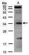 Fructosamine 3 Kinase Related Protein antibody, GTX104964, GeneTex, Western Blot image 