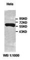 Zinc Finger And BTB Domain Containing 42 antibody, orb77480, Biorbyt, Western Blot image 