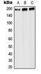 Replication protein A 70 kDa DNA-binding subunit antibody, LS-C353779, Lifespan Biosciences, Western Blot image 