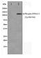 EPH Receptor A2 antibody, TA348421, Origene, Western Blot image 