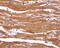 Beta-Secretase 2 antibody, PA5-19950, Invitrogen Antibodies, Immunohistochemistry paraffin image 