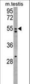 Anti-Mullerian Hormone Receptor Type 2 antibody, LS-C98097, Lifespan Biosciences, Western Blot image 